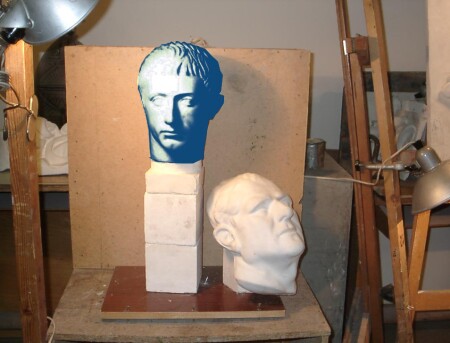 атипичная пневмония