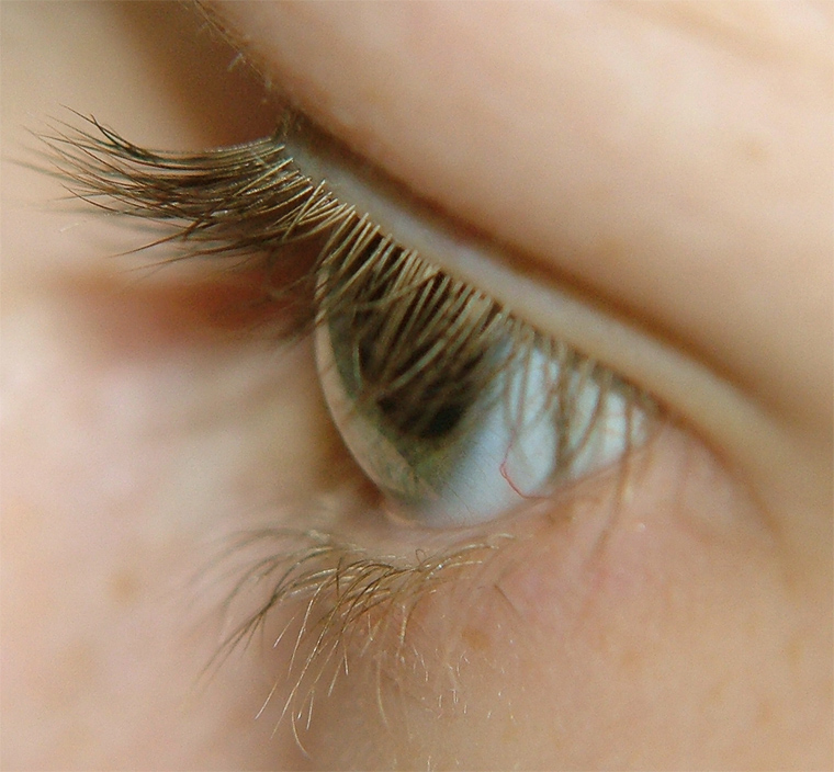 Eye
