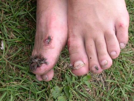 мухи - людоеды!