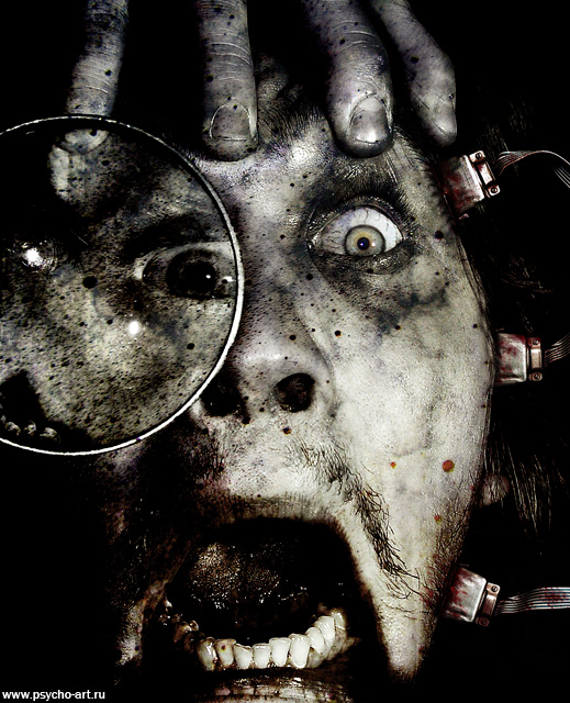 Catatonic Syndrome