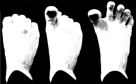 Театр одной ноги