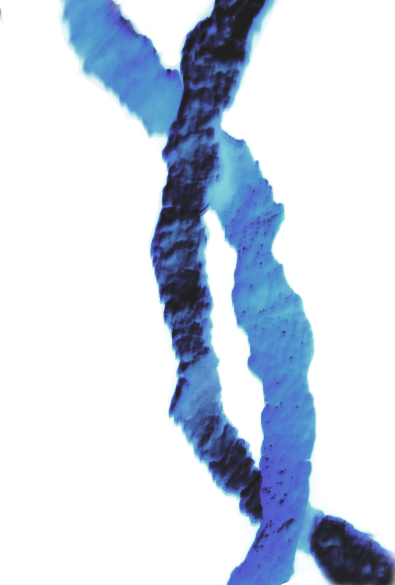 DNA
