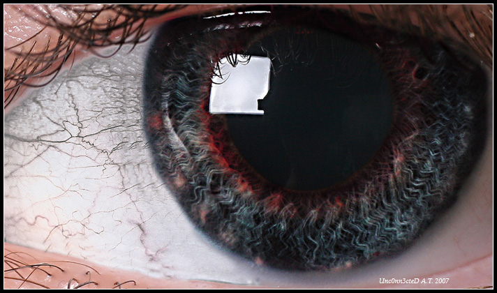 Ophthalmologist bad dream