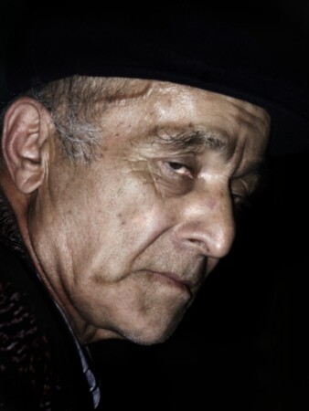 Перед операцией