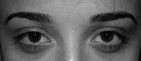 Eyes