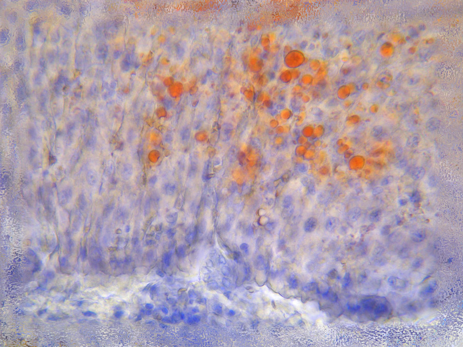 Зал Hepar, стиль Lipidosis