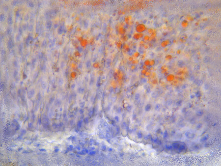 Зал Hepar, стиль Lipidosis