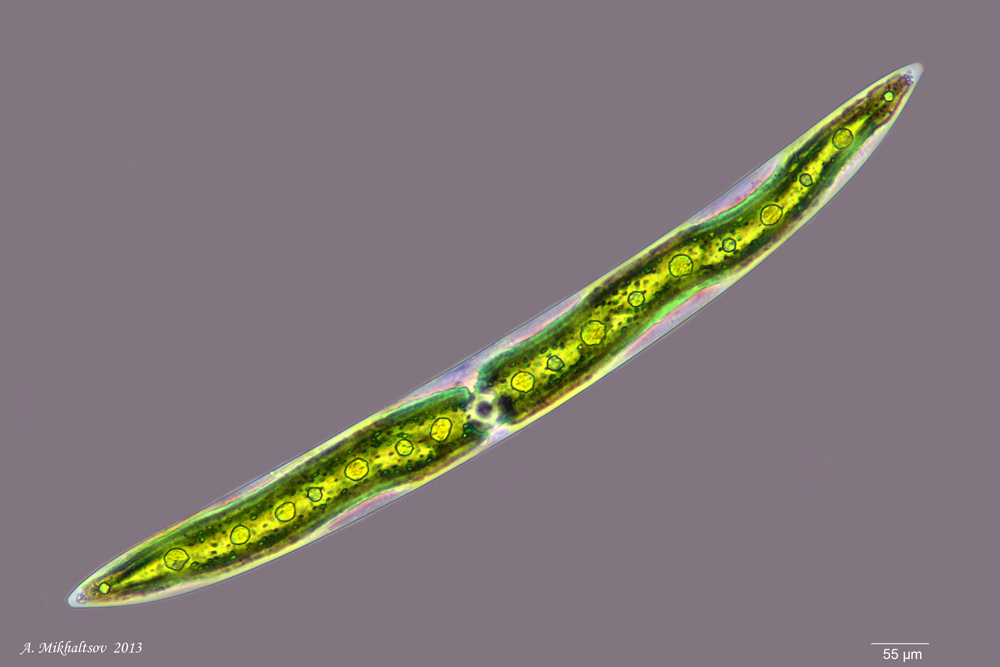 Closterium acerosum